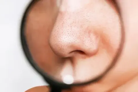 毛穴は「閉じる」ことができるのか:皮膚生理学が突きつける残酷な真実と希望